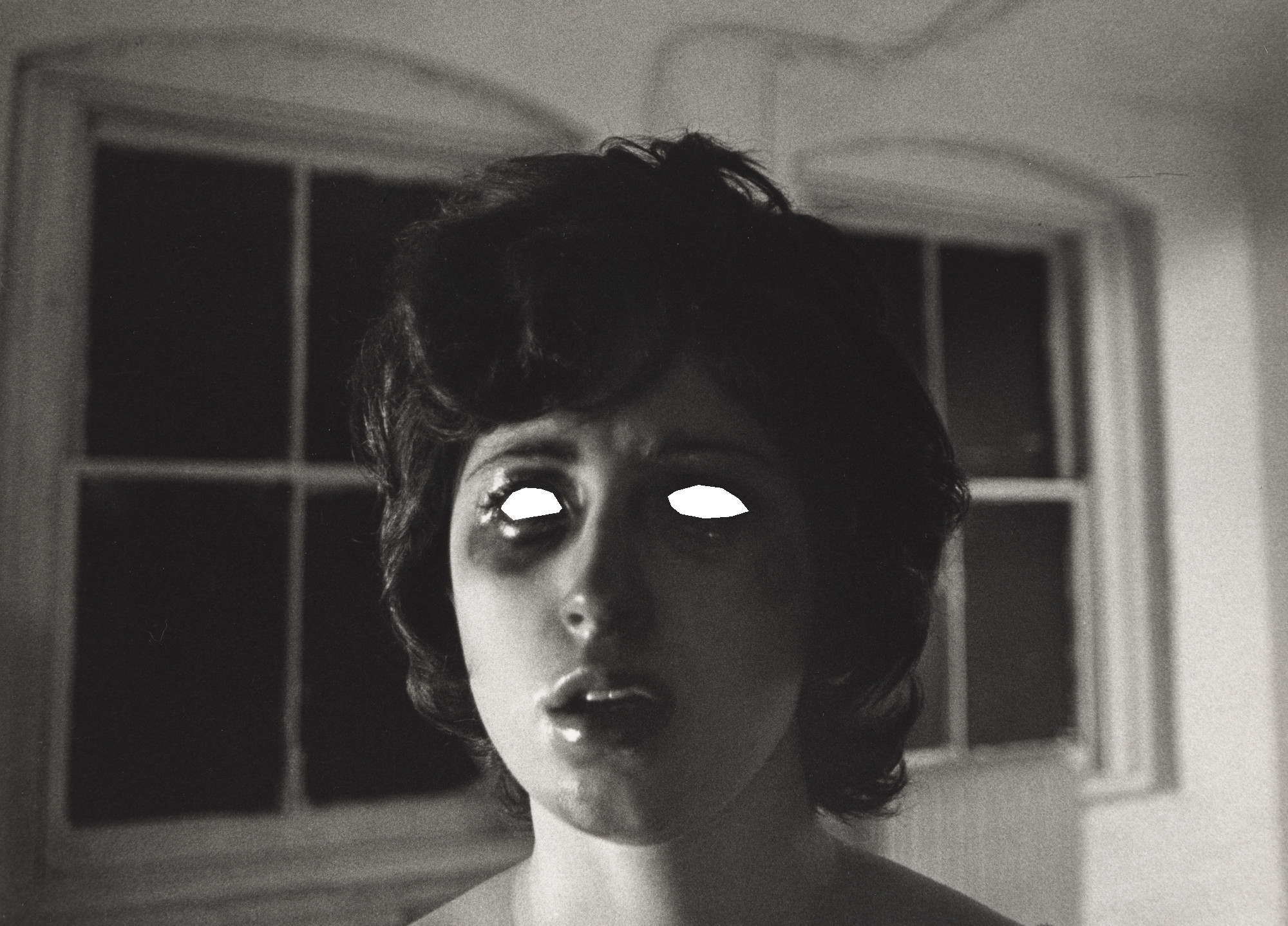 Black and white picture of a woman with dark circles under eyes